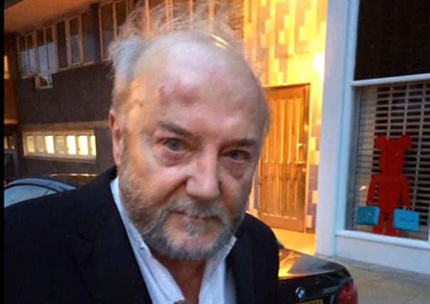 The Twitter photo shows George Galloway on his way to hospital after being attacked.  Photograph: @ukrespectparty/Twitter/PA