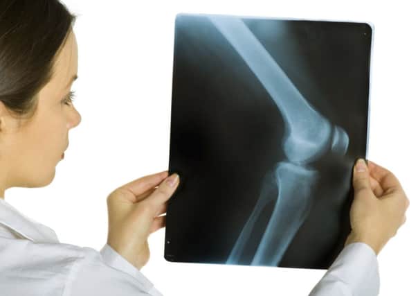 Revisions to  knee replacements cost more than original surgery. Picture: Getty