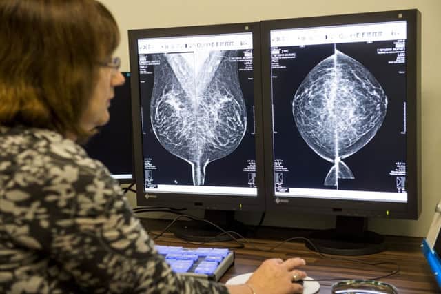 Mammogram scans may be unable to detect hidden tumours due to high breast density. Picture: Ian Georgeson