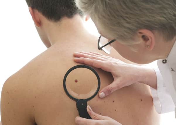 The research may help stop the spread of skin cancer. Picture: Alex Raths