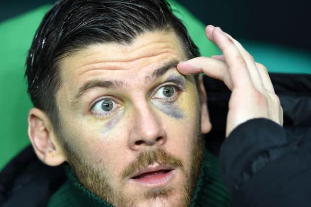 Celtic goalkeeper Lukasz Zaluska was left with facial injuries after the incident. Picture: TSPL