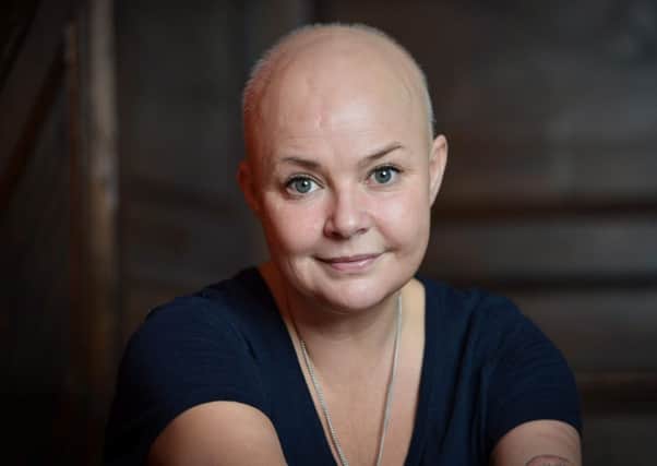 Gail Porter has revealed her hair is starting to grow back after a diet of raw cabbage. Picture: SWNS