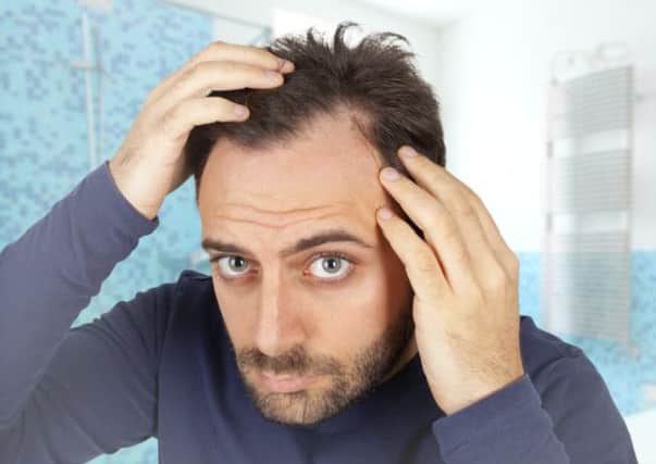 New treatments for hair loss could be on their way. Picture: Getty