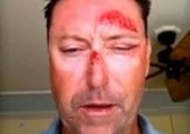 Australian golfer Robert Allenby after being kinapped and robed in Hawaii