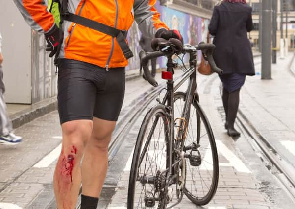 Gwo-Tzer Ho shows off his cycling injuries at Haymarket, Edinburgh. Picture: Contributed