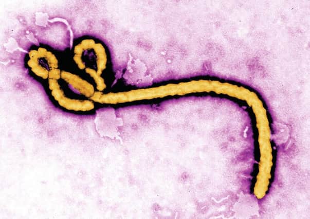 The Ebola virus. Picture: PA