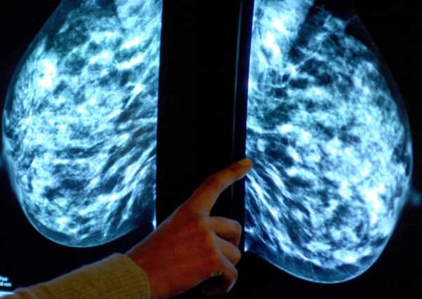 Evidence fails to support claims that most cancers are due to bad luck. Picture: PA