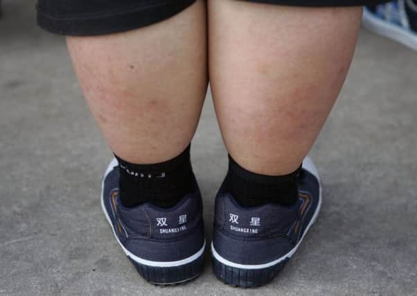 There were about 3,503 children in Primary One last year (2013/14) who were found to be obese or clinically obese. Picture: Getty