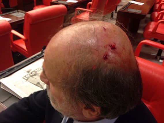 An opposition lawmaker listens to a debate after being injured during the brawl. Picture: AP