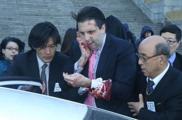 Ambassador Lipper was taken to a hospital in Seoul, where he was said to be stable. Picture: AFP/Getty
