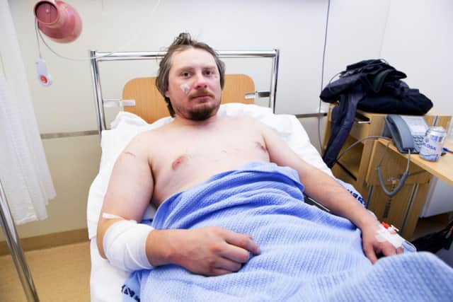 Jakub Moravec is recovering after being attacked by a polar bear whilst sleeping in a tent. Picture: AP