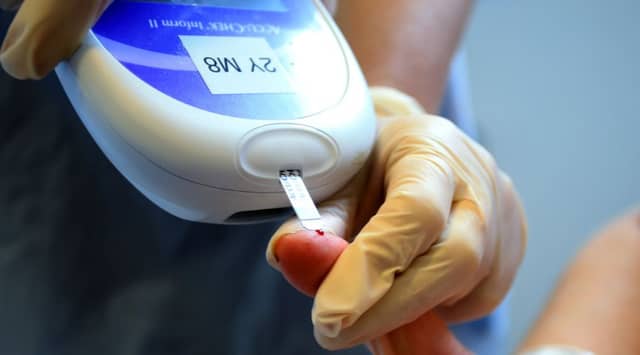 Researchers at Glasgow University analysed results from more than 132,000 patients. Picture: PA