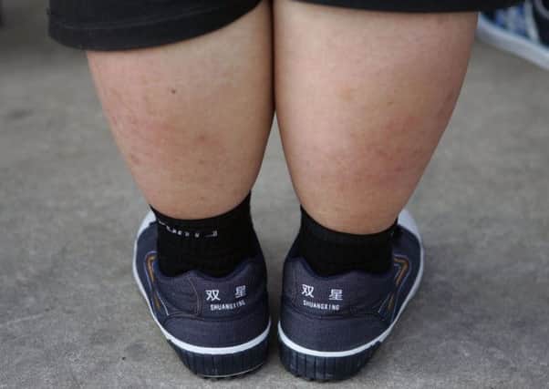 In the study only one per cent of parents underestimated their child's weight. Picture: Getty