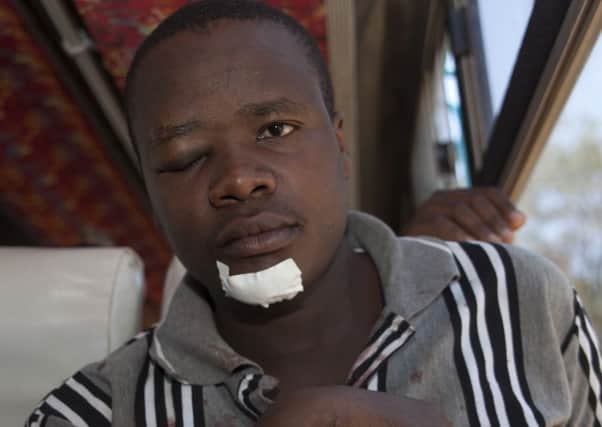 An injured university student leaves  in a bus after treatment at Kenyatta National Hospital in Nairobi, Kenya. Picture: AP
