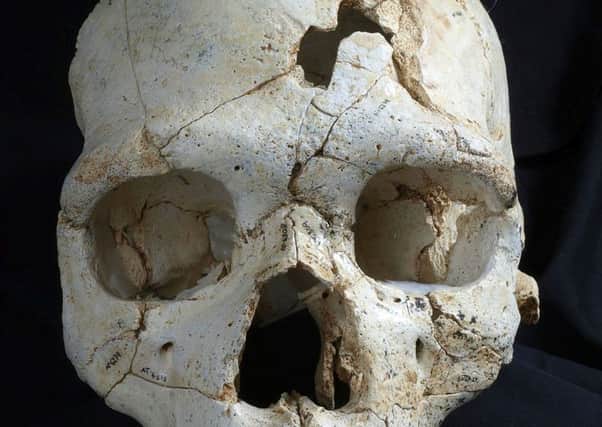430,000-year-old skull which scientists believe may have belonged to the world's first confirmed murder victim. Picture: PA
