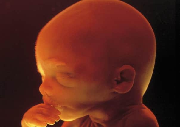 John Mason MSP said he would like to see the UK abortion limit of 24 weeks cut. Picture: James Stevenson