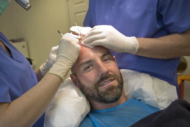 Kris Boyd has undergone a hair transplant ahead of the new season. Picture: PA