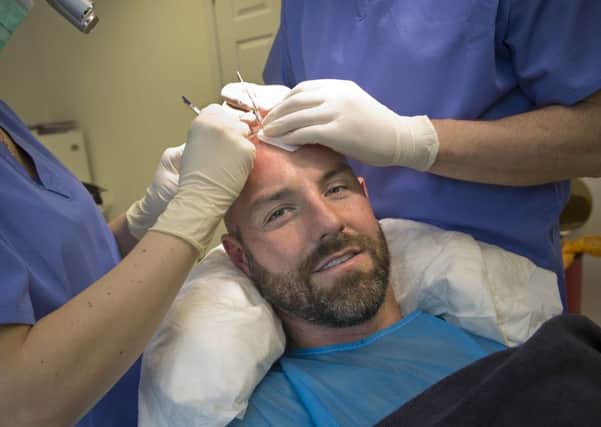 Kris Boyd has undergone a hair transplant ahead of the new season. Picture: PA