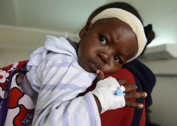 18-month-old boy Satrin Osinya recovered after receiving treatment in Nairobi. Picture: AFP/Getty