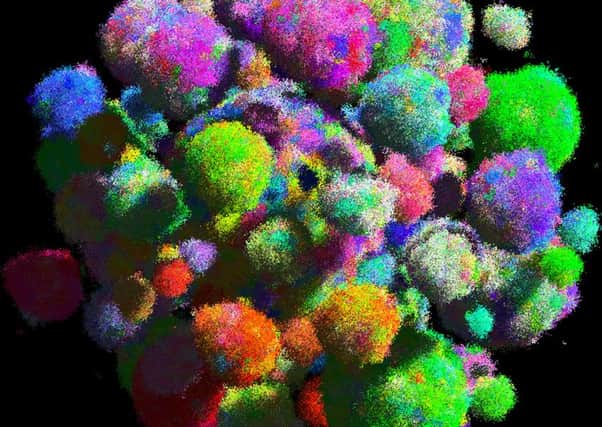 The 3D tumour model created at Edinburgh University can help to track rogue cell behaviour. Picture: Edinburgh University