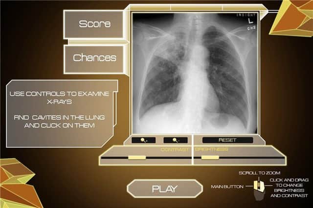 Project Sanitarium makes virtual medics out of gamers. Picture: Contributed