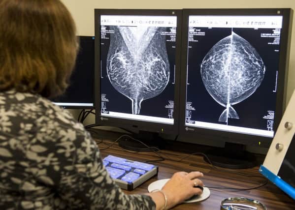 Over half of Scottish women don't check their breasts for signs of cancer