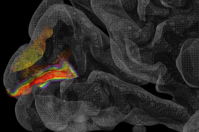 Now scientists can read much more of the brain than they could before Picture: Lars Muckli