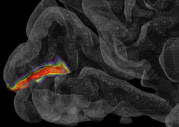 Scientests can now isolate different signals in six layers of the cortex