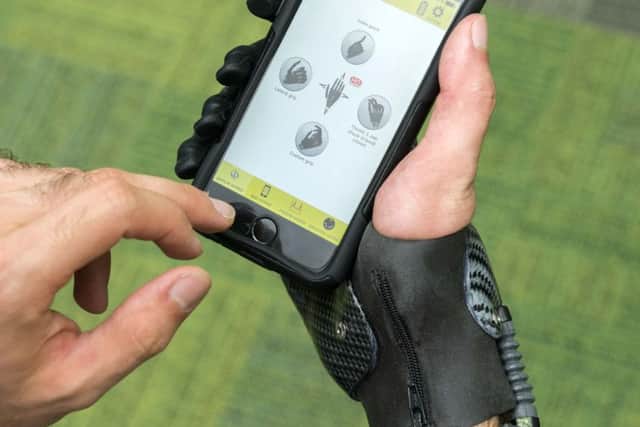 Touch Bionics said the i-digits device is the first of its kind to change grips with a simple gesture