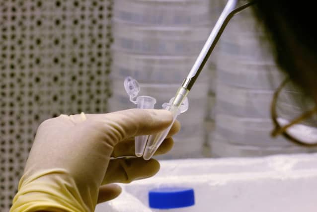 A World Health Assembly Resolution called for concerted action to reverse the ever-rising death toll from viral hepatitis. Picture: Getty