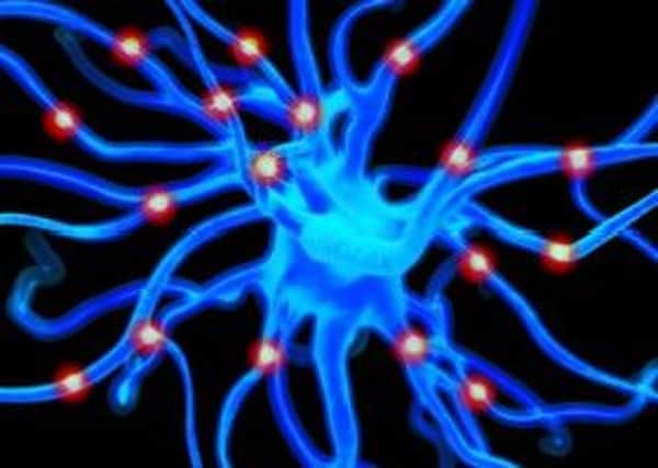 Alzheimer's damages nerve cells (above) and causes memory loss and behavioural changes. Picture: Contributed