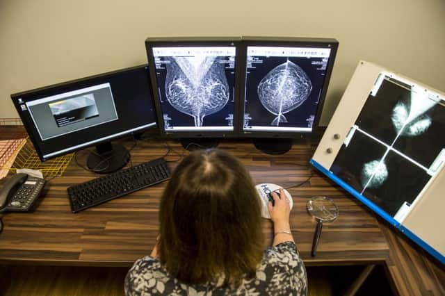 Researchers in London have developed a test to show if breast cancer is likely to spread to the brain. Picture: Ian Georgeson