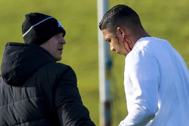 Emilio Izaguirre sports a bloody ear as he leaves the training field with physio Tim Williamson. Picture: SNS Group