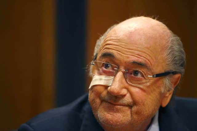 Blatters fighting talk was delivered while still sporting a strip of surgical tape on his right cheek. Picture: AP