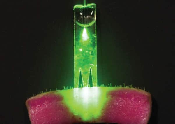 Bioabsorbable optical waveguides can be implanted into tissue to deliver light deeper and more effectively.  Image: University of St Andrews