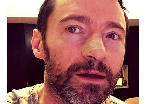 Hugh Jackman, who took to social media to warn fans of the dangers of not wearing sunscreen. Picture: PA