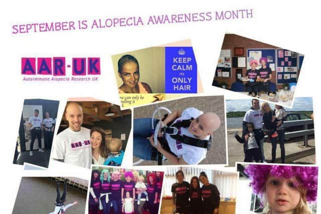 AAR-UK are trying to raise the profile of alopecia in the UK
