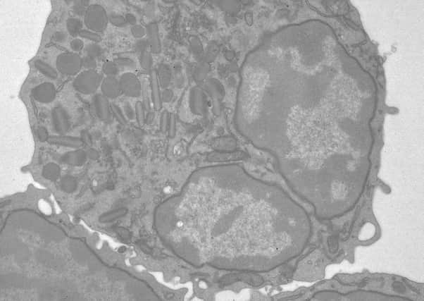 Professor Colin Watts says eosinophils cells help protect people from infectious agents. Picture: Contributed