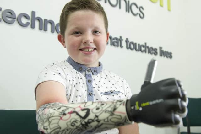 Nine-year-old Josh Cathcart was the first person in the UK to be fitted with Touch Bionics' new bionic hand. Picture: Ian Rutherford