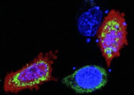 Kill cancer: scientists working in Glasgow are leading research into how  cancer cells can be killed by getting them addicted to certain drugs. Picture: Glasgow University.