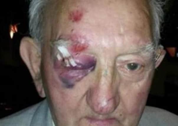 Injuries of Glasgow assault victim were posted on social media, who named the 84-year-old as Willie. Picture: Submitted