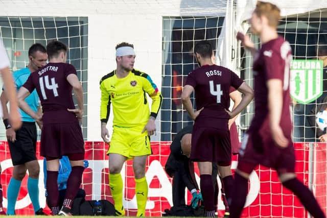 Hearts goalkeeper Jack Hamilton required stitches.