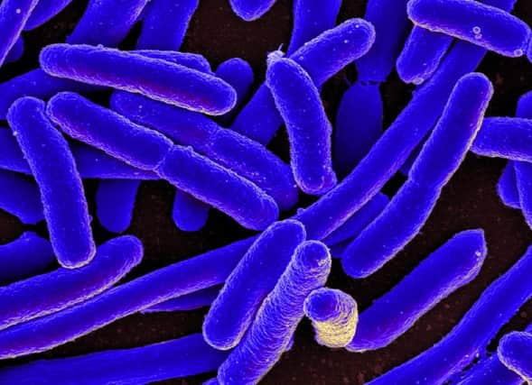 There have been 16 confirmed cases of E.coli 0157. Picture: TSPL
