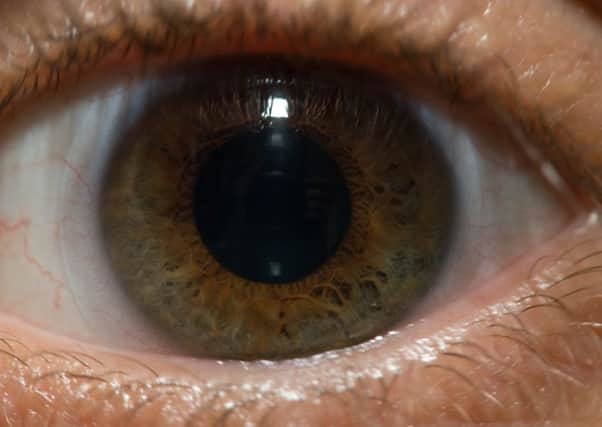 A simple test of eye movements developed at Aberdeen University could help diagnose psychiatric illness more quickly. PIC Stefan Schroeder/Wikicommons.