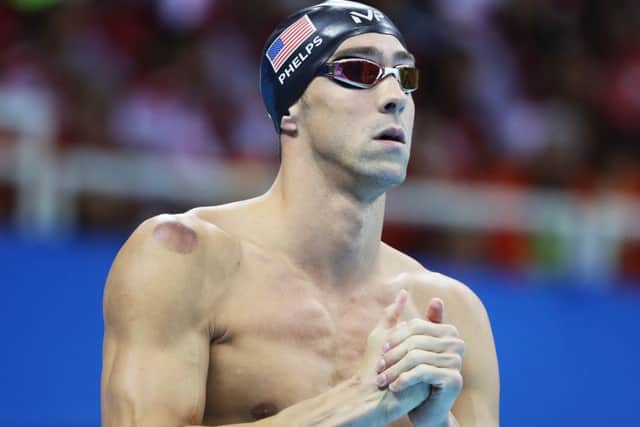 Michael Phelps with the red circle on his shoulder. Picture: Getty