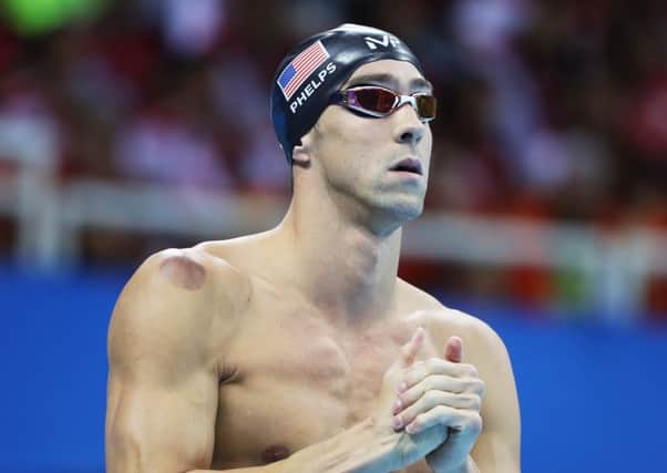 Michael Phelps with the red circle on his shoulder. Picture: Getty