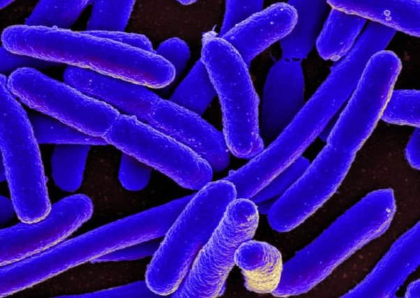 There have been 20 confirmed cases of E.coli 0157. Picture: TSPL