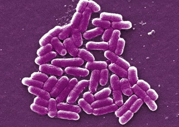 A 'small number' of children have fallen ill with E. coli. Picture: PA