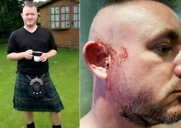Christopher Baxter says he was attacked because he was wearing a kilt. Picture: Ross Parry Agency