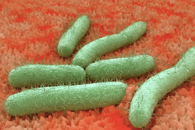 An image of E. Coli bacteria